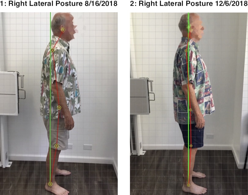 Natural Ways to Improve Posture and Align the Spine - Elliott Chiropractic,  PLC
